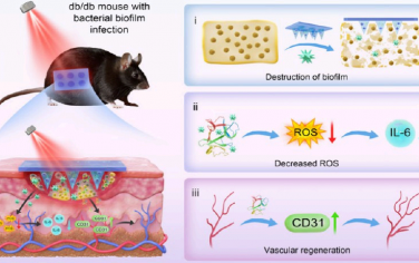 Nano Lett：具有消除生物膜和血管生成作用的光熱共軛聚合物微針用于促進糖尿病創面愈合
