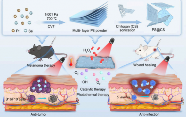 Nano Lett：NIR-II光驅動的多功能納米酶用于治療黑色素瘤和腫瘤手術后感染