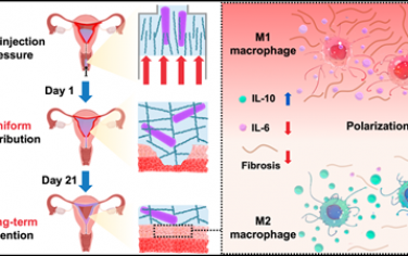 ACS Nano：負載乳酸桿菌的可注射水凝膠可通過長期保留和調節微環境促進子宮內膜修復